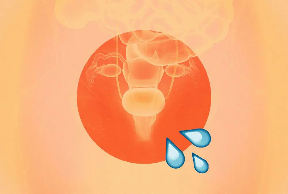 Urinary Incontinence