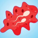 Blood in Semen: Symptoms, Causes, and Treatment Options
